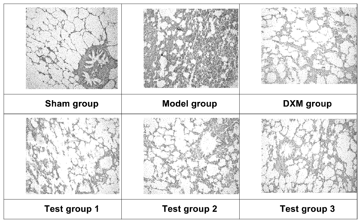 Pharmaceutical composition for treating respiratory disease