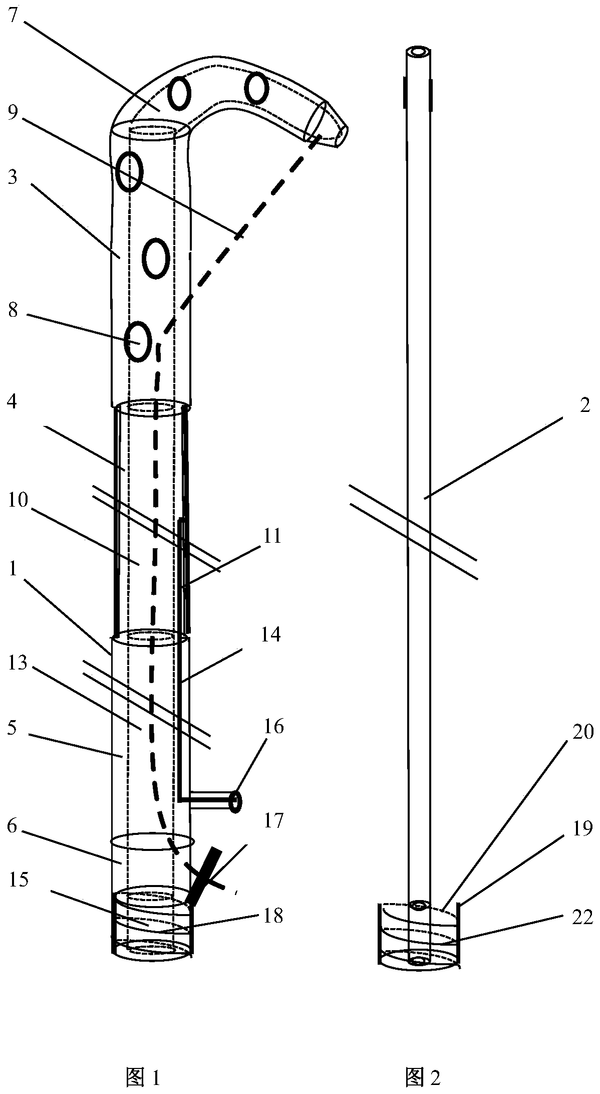 Direct puncture type fistula expansion type drainage tube