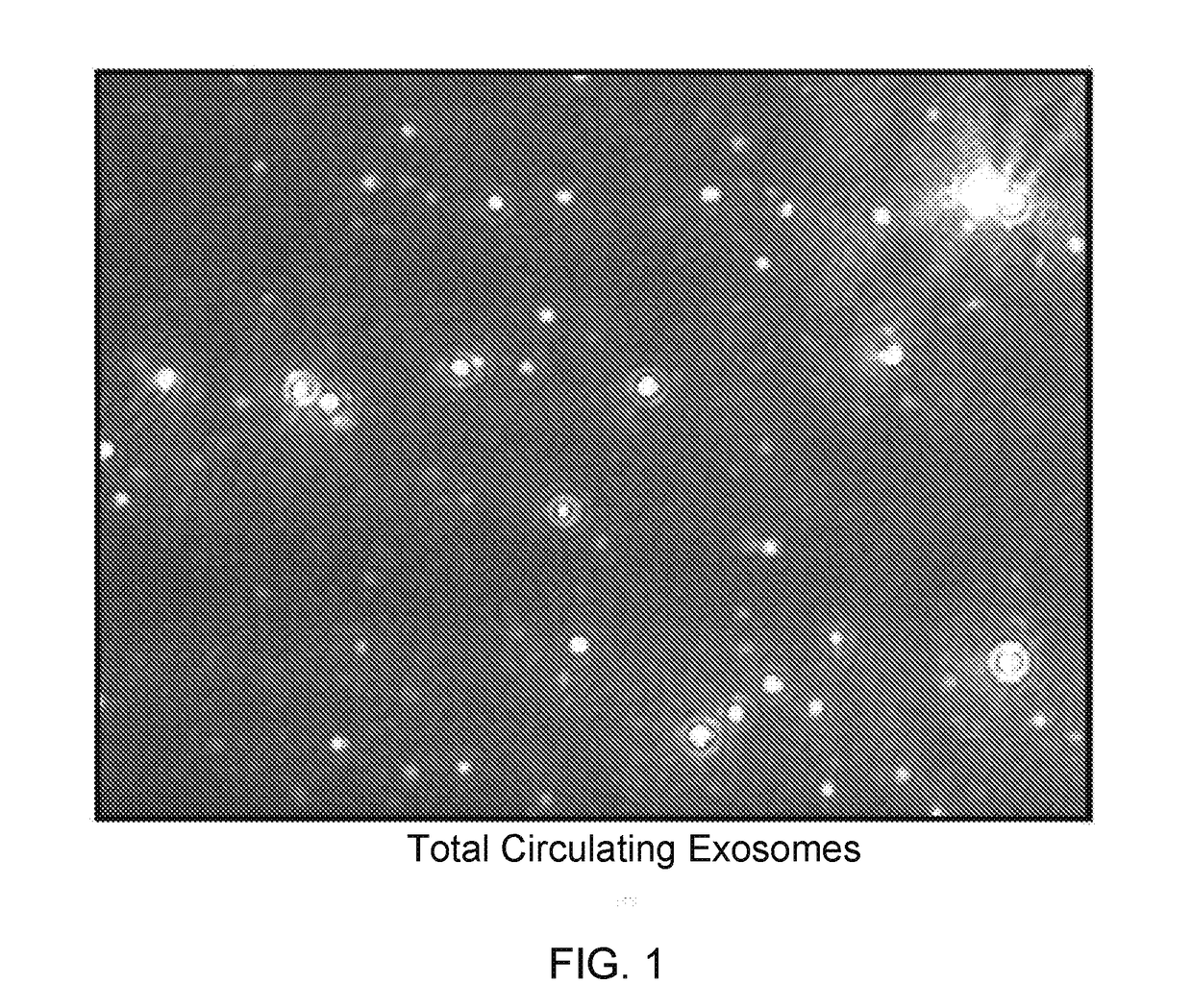 Exosomal tau as a biomarker for brain disorders