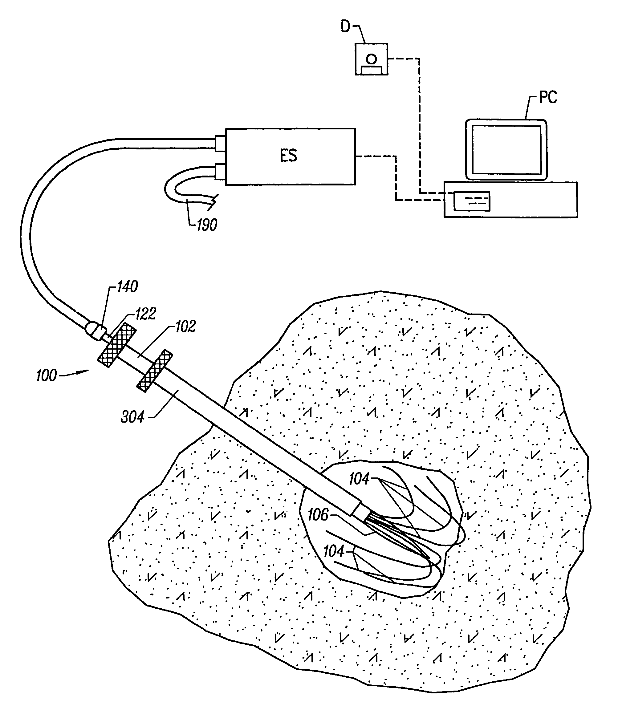 Method and system for heating solid tissue