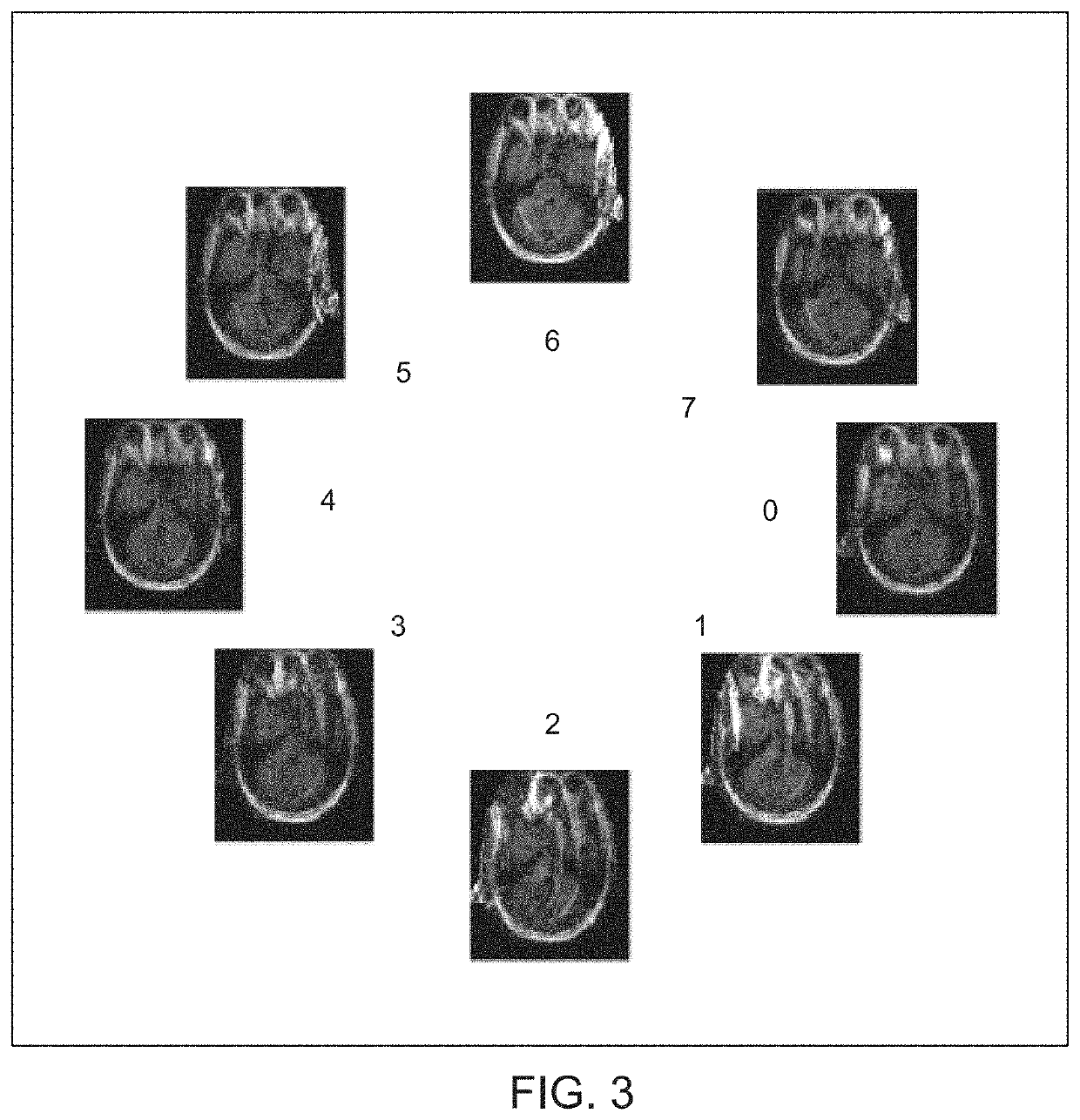 MRI system and method for detection and correction of patient motion