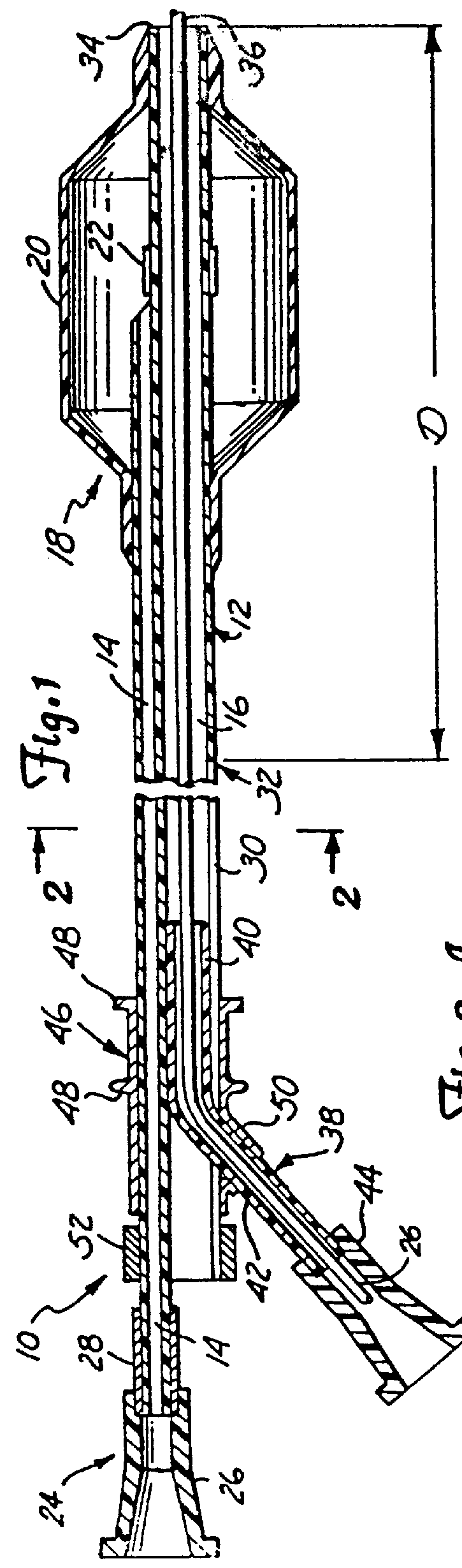 Interlocking peel-away dilation catheter