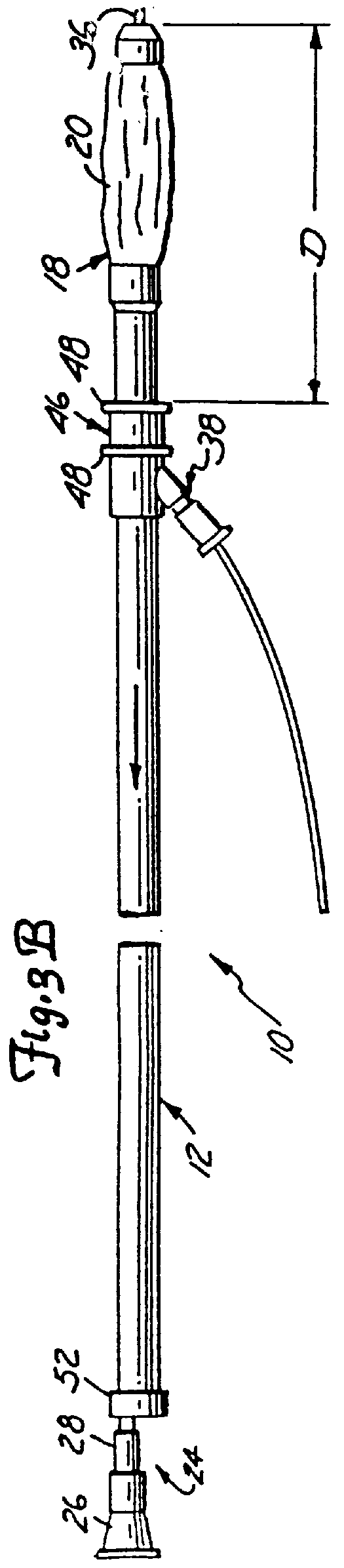 Interlocking peel-away dilation catheter