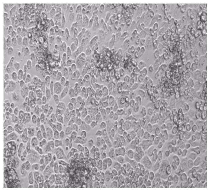 Recombinant retrovirus for primary T cell infection, infection method and application thereof