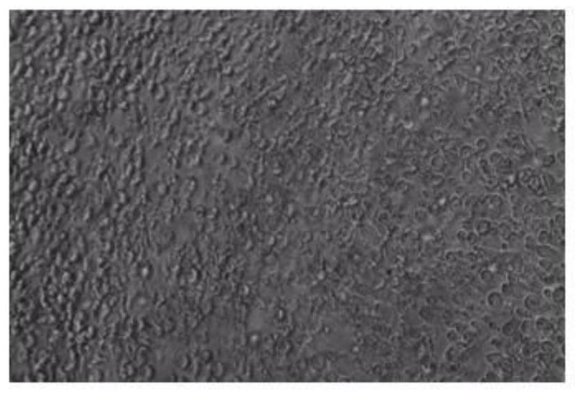 Recombinant retrovirus for primary T cell infection, infection method and application thereof