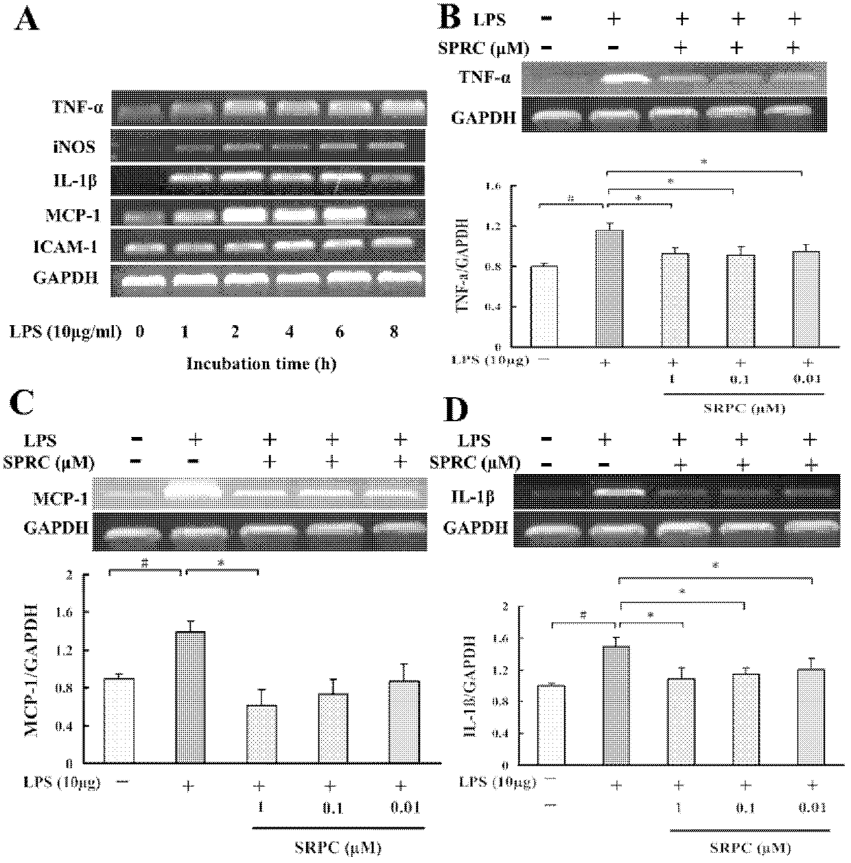 Application of propargyl cysteine and analogues thereof in preparation of medicaments for preventing and treating diseases related to cardiovascular system inflammation