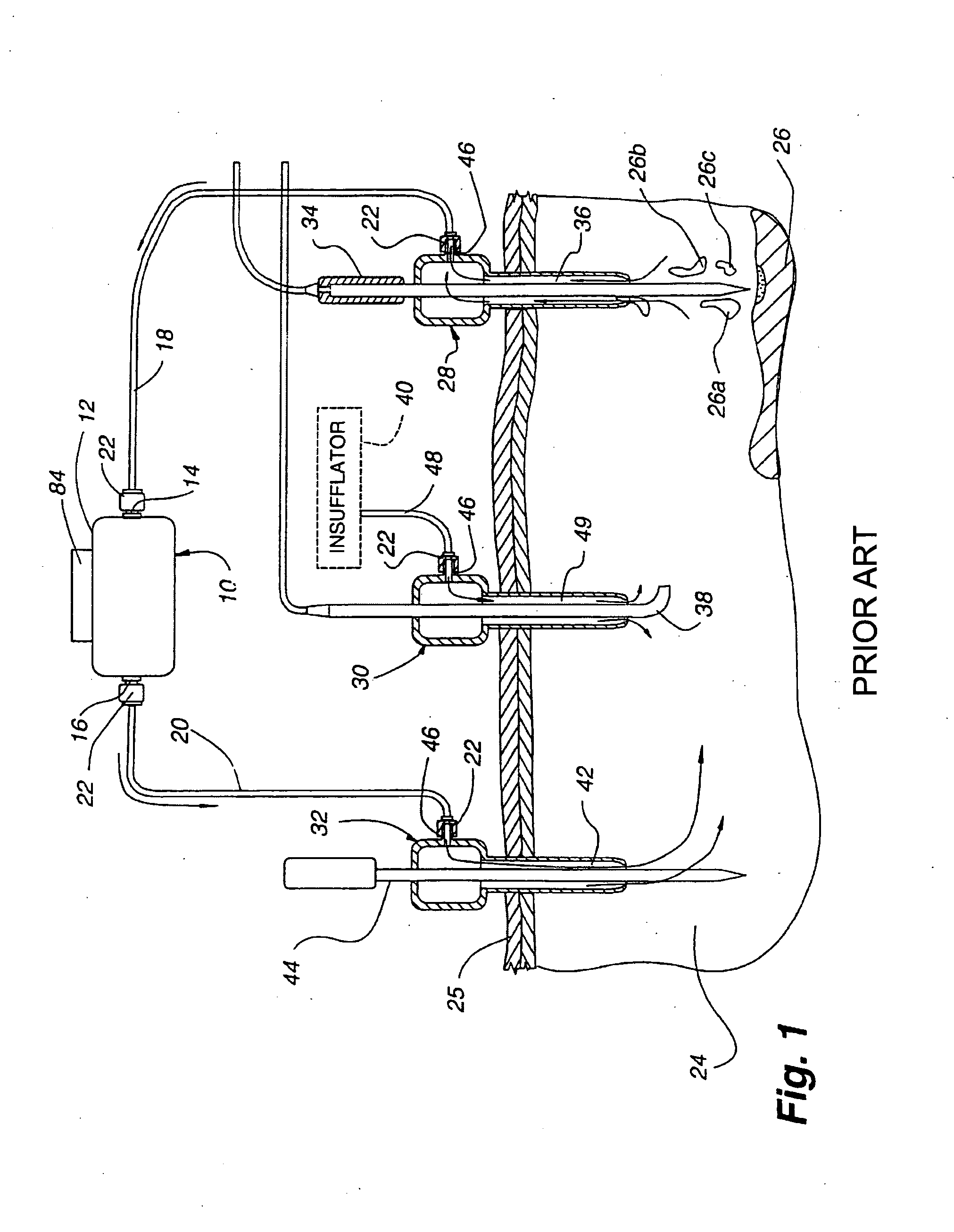 Wick and relief valve for disposable laparoscopic smoke evacuation system