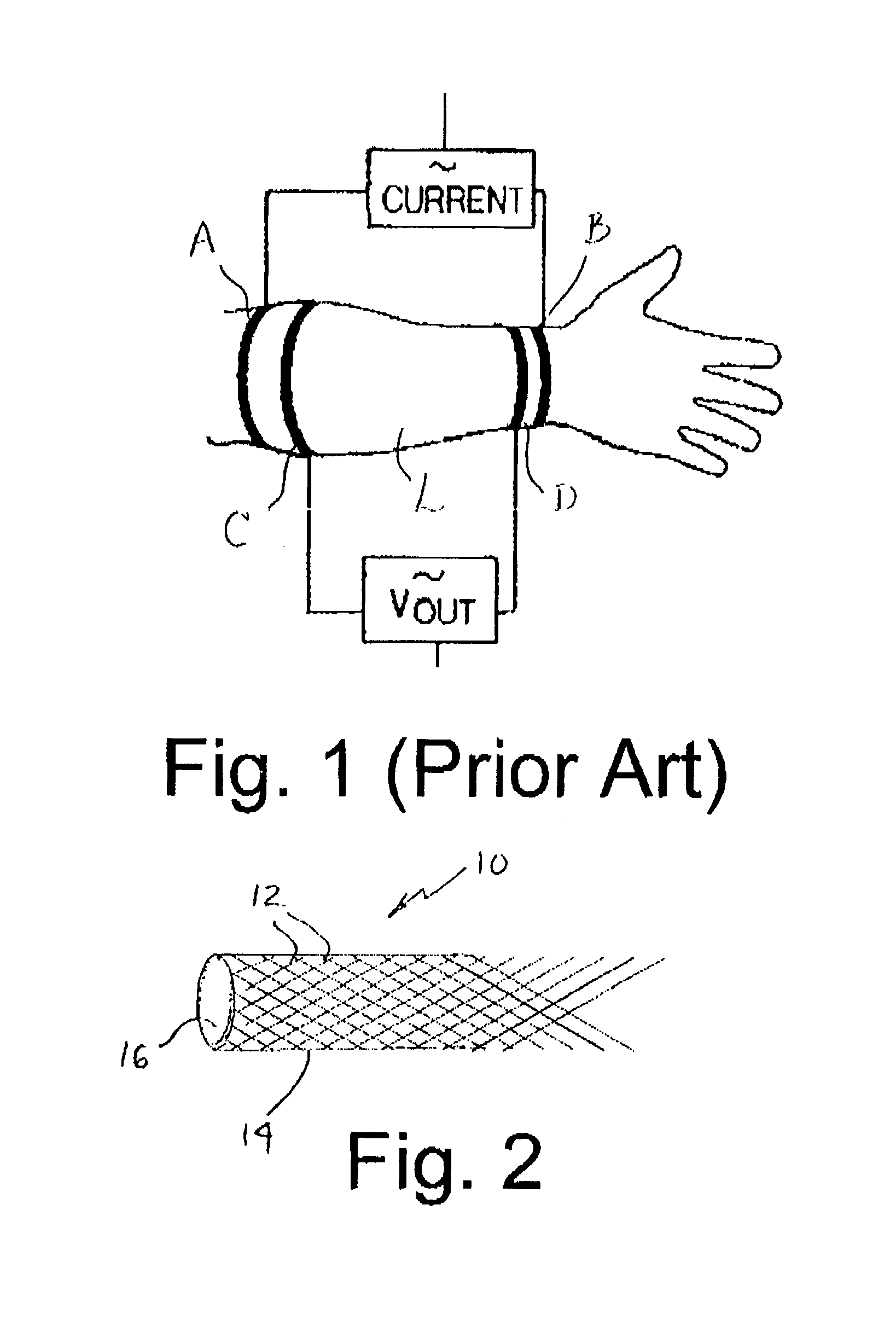 Stretchable electrode and method of making physiologic measurements