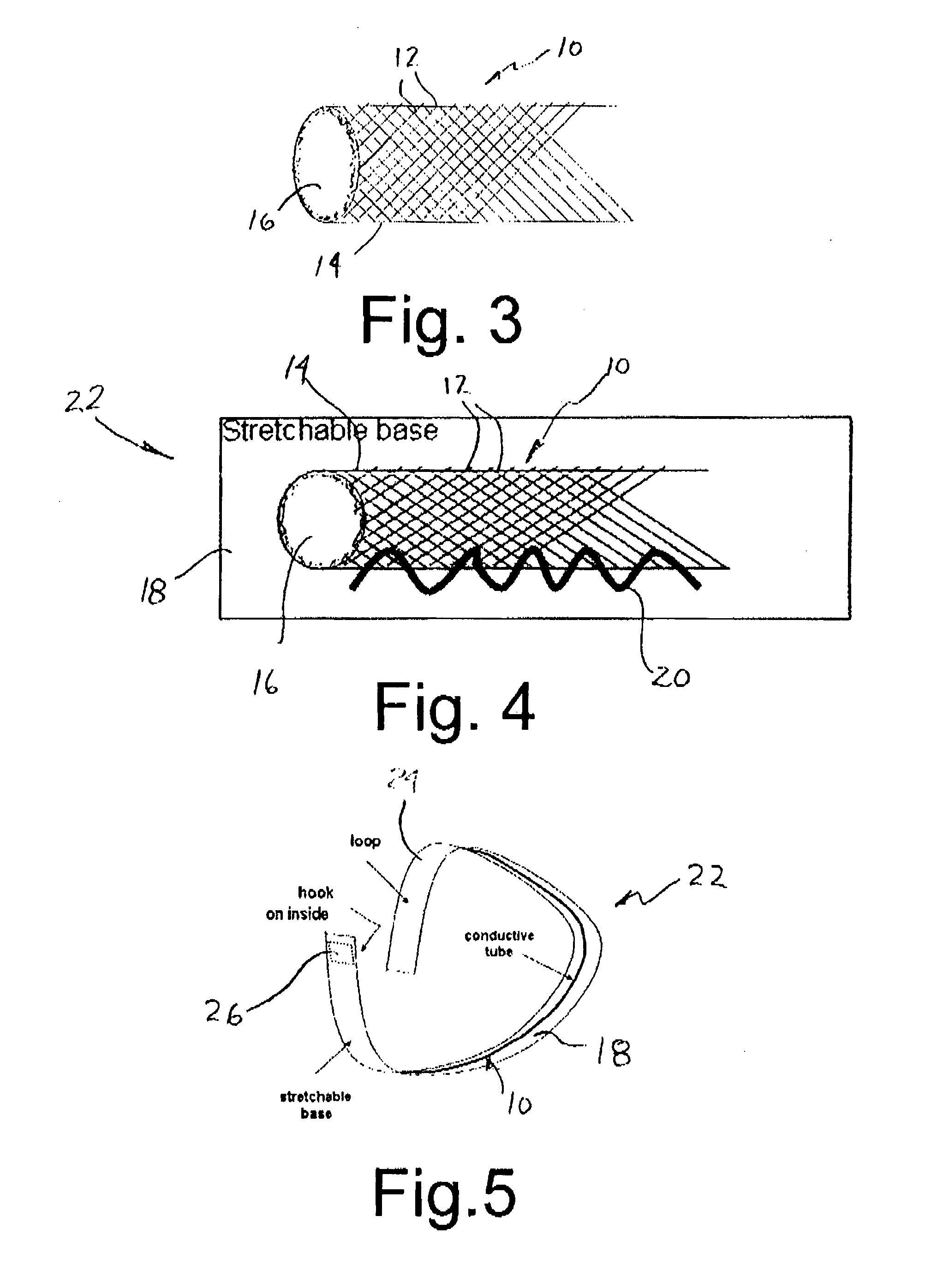 Stretchable electrode and method of making physiologic measurements