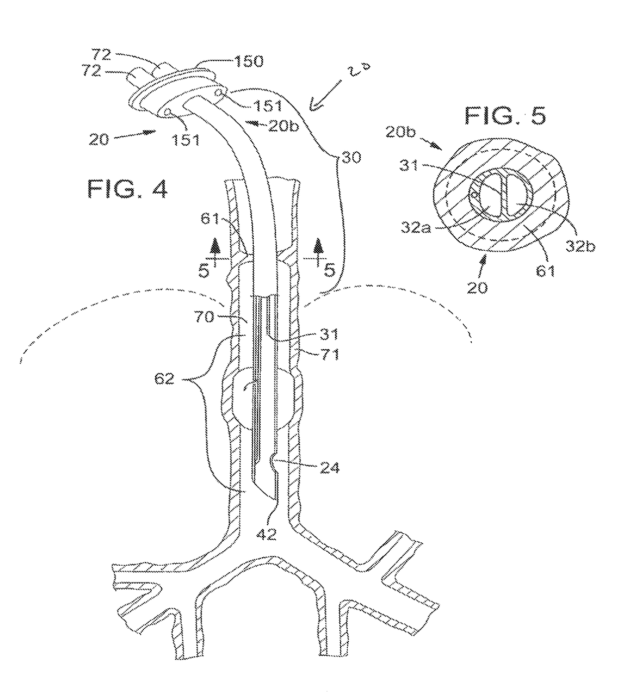 Secretion clearing patient airway management system