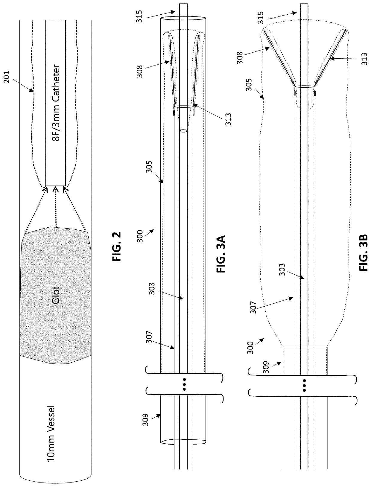 Inverting thrombectomy apparatuses and methods of use