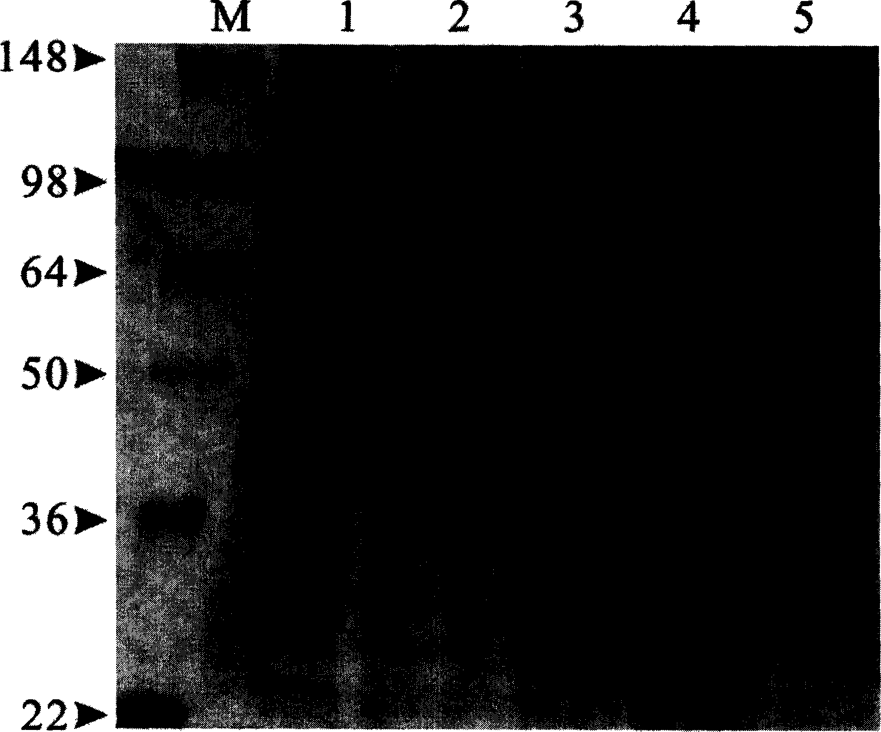 Microbial L. rhamnosus GM-020 and its use for treating obesity