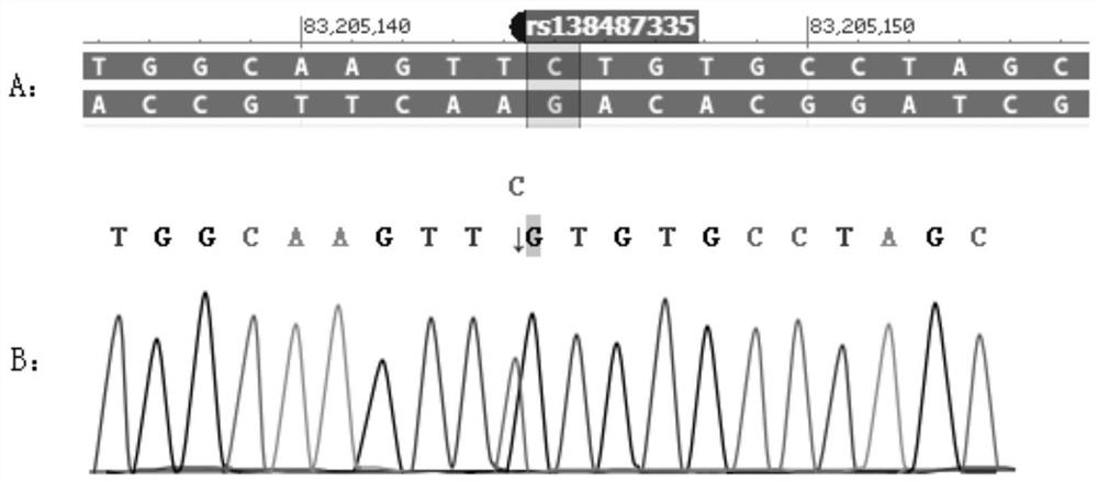 Gene marker for detecting amyotrophic lateral sclerosis, detection method and application