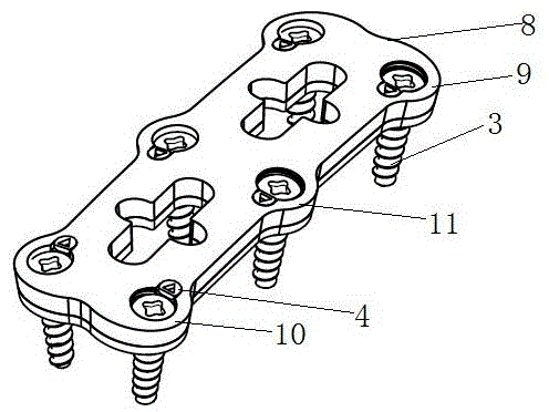 Spinal fixation device