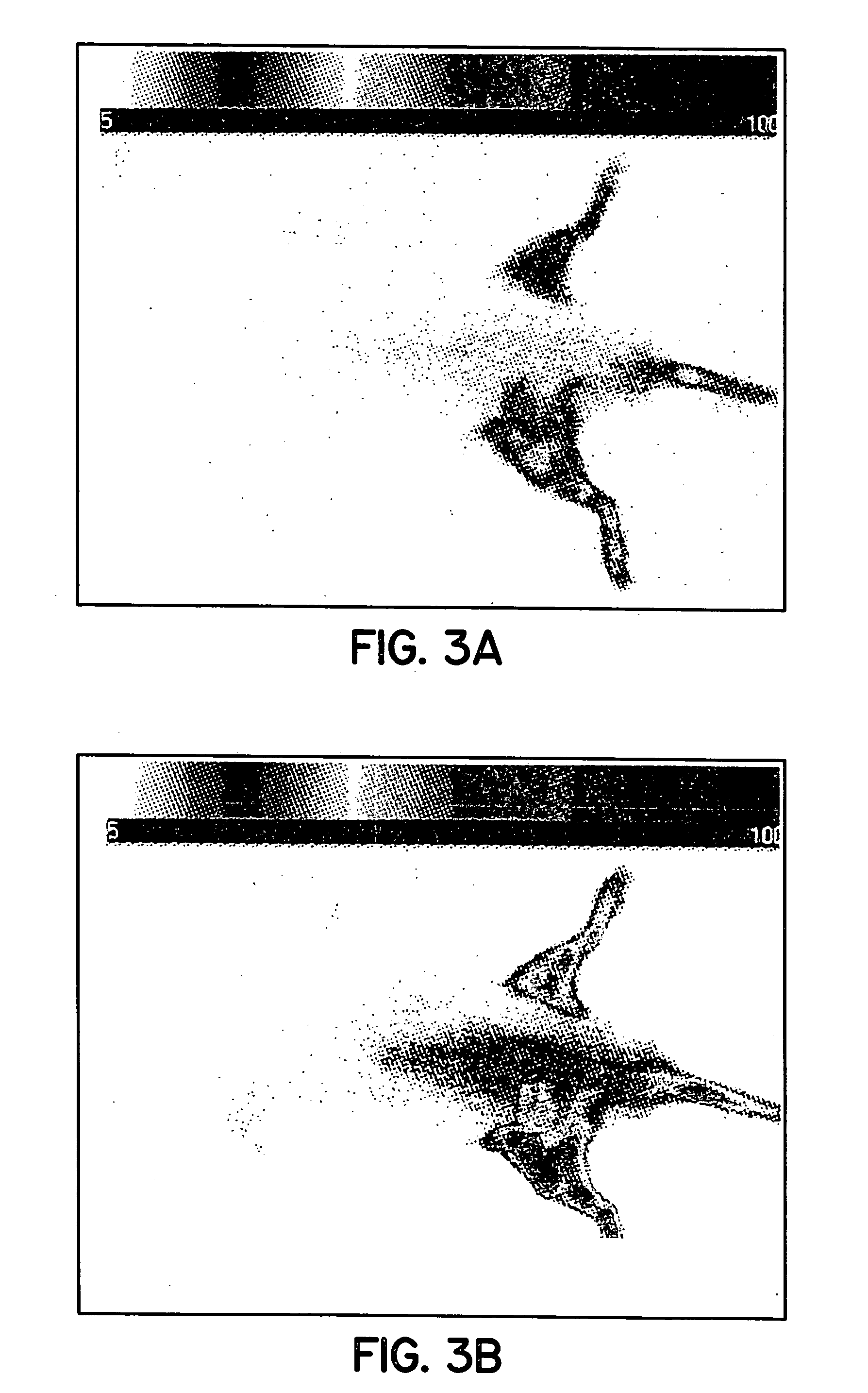 Pathological tissue detection and treatment employing targeted optical agents