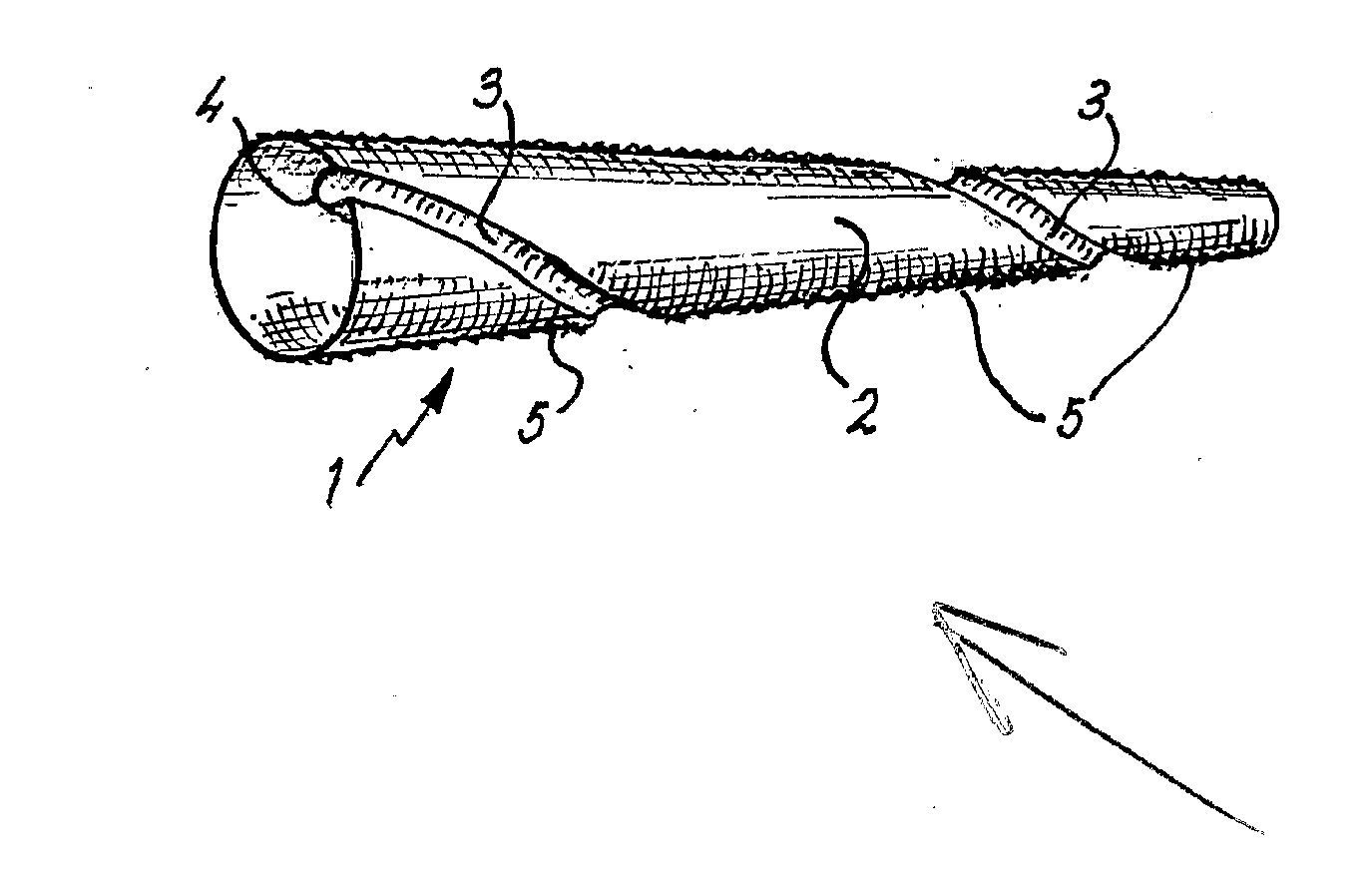 Helical Formation for a Conduit