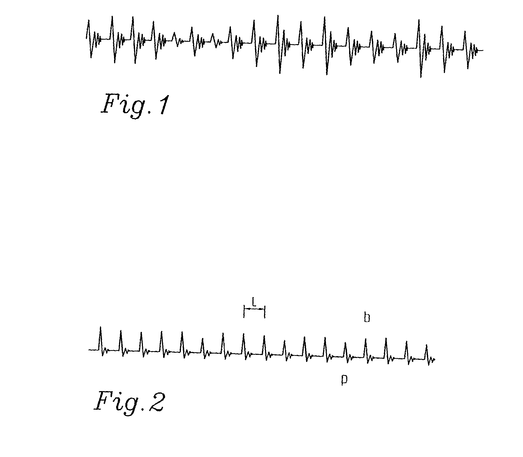Method of dynamically adapting the size of a jitter buffer