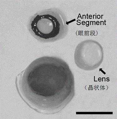 Separation culture method of human fetal retinal pigment epithelial cells