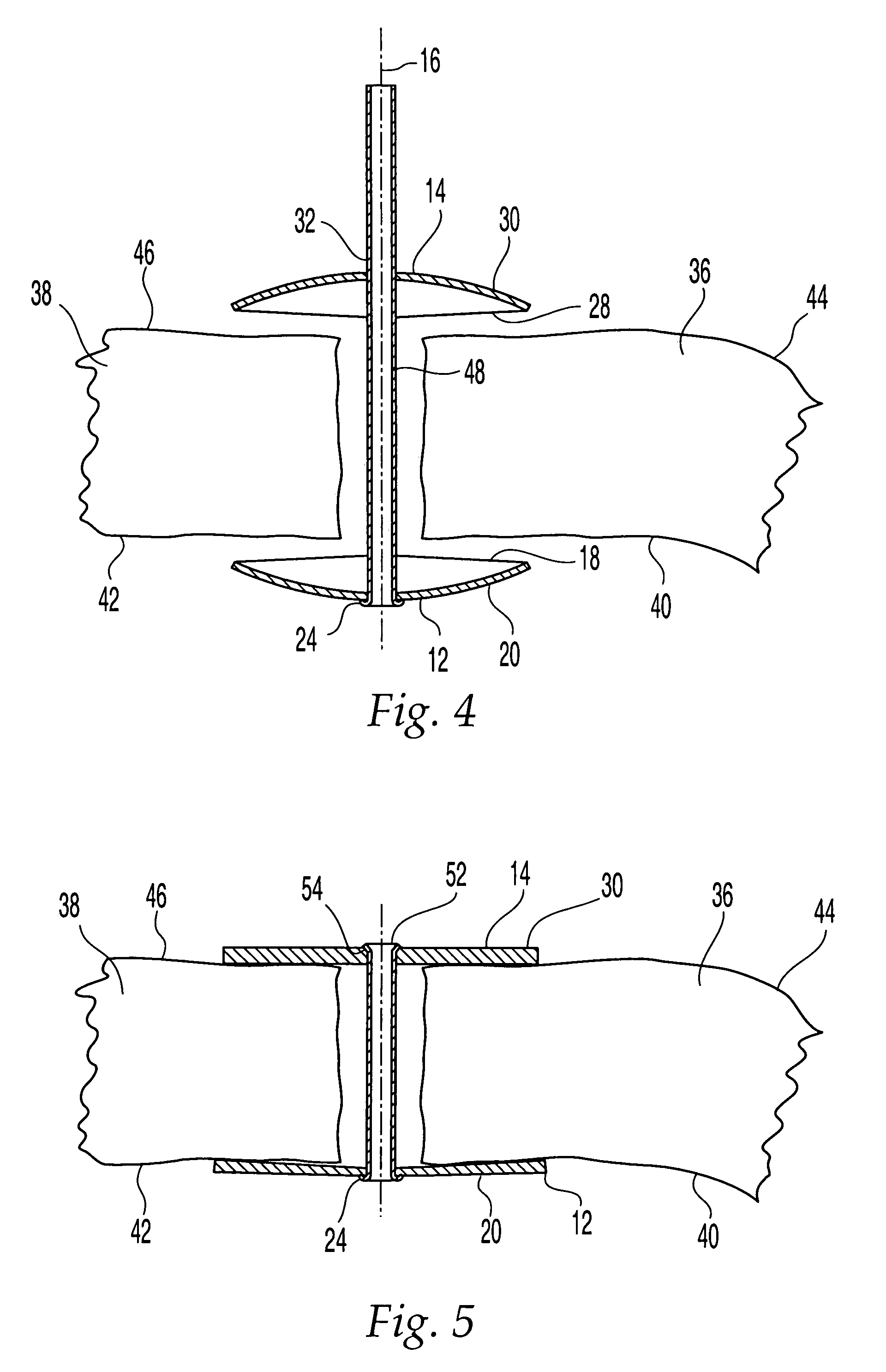 Cranial flap clamp and instrument for use therewith