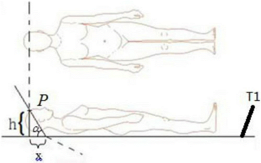 Body surface location method and device