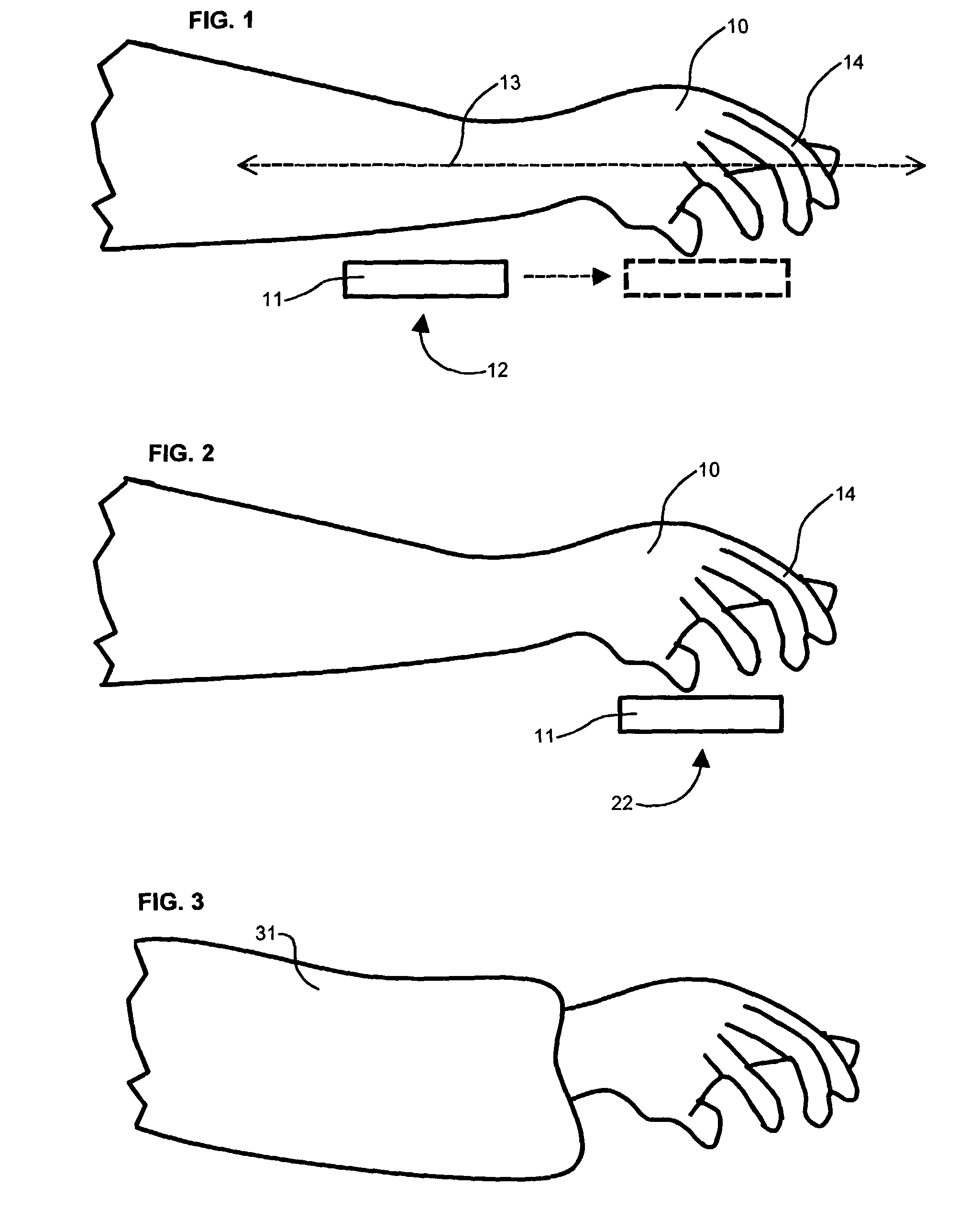 Flexion-discouraging splint system, method and device