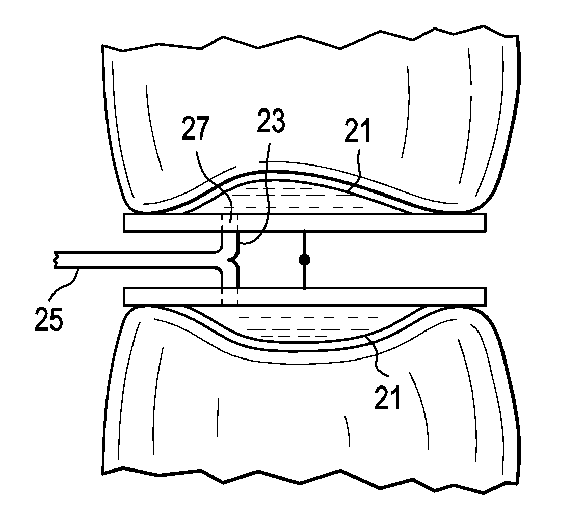 Patient-Specific Spinal Fusion Cage and Methods of Making Same