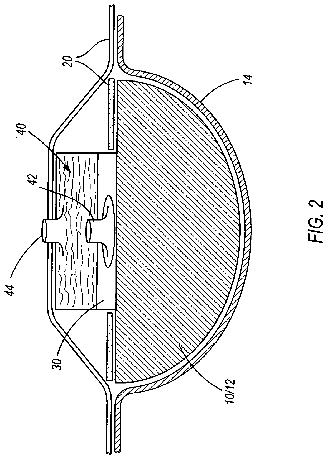 Wound Dressing containing a vacuum pump