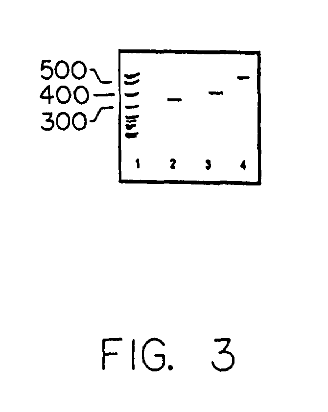 Methods for identifying or diagnosing carcinoma cells with metastatic potential based on the measurement of lymphoid genes or their products in carcinoma cells