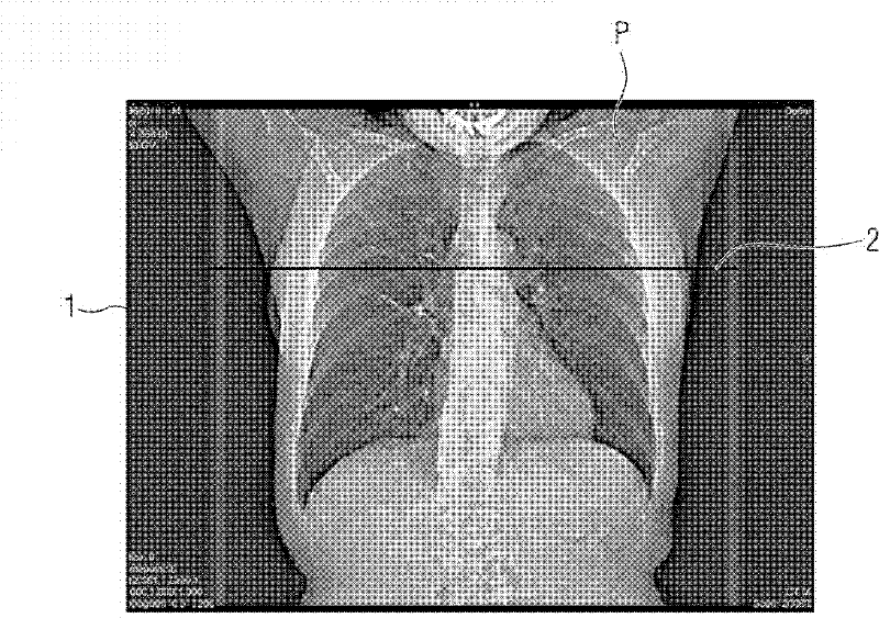 Method for automatic detection of a contrast agent inflow in a blood vessel of a patient with a CT system and CT system for carrying out this method