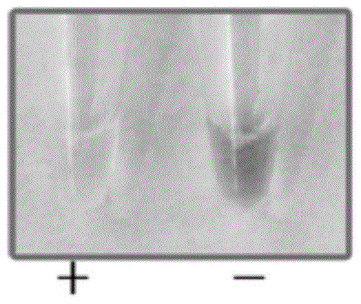 A kind of loop-mediated isothermal amplification primer composition and application thereof for detecting glyospora anthracnose