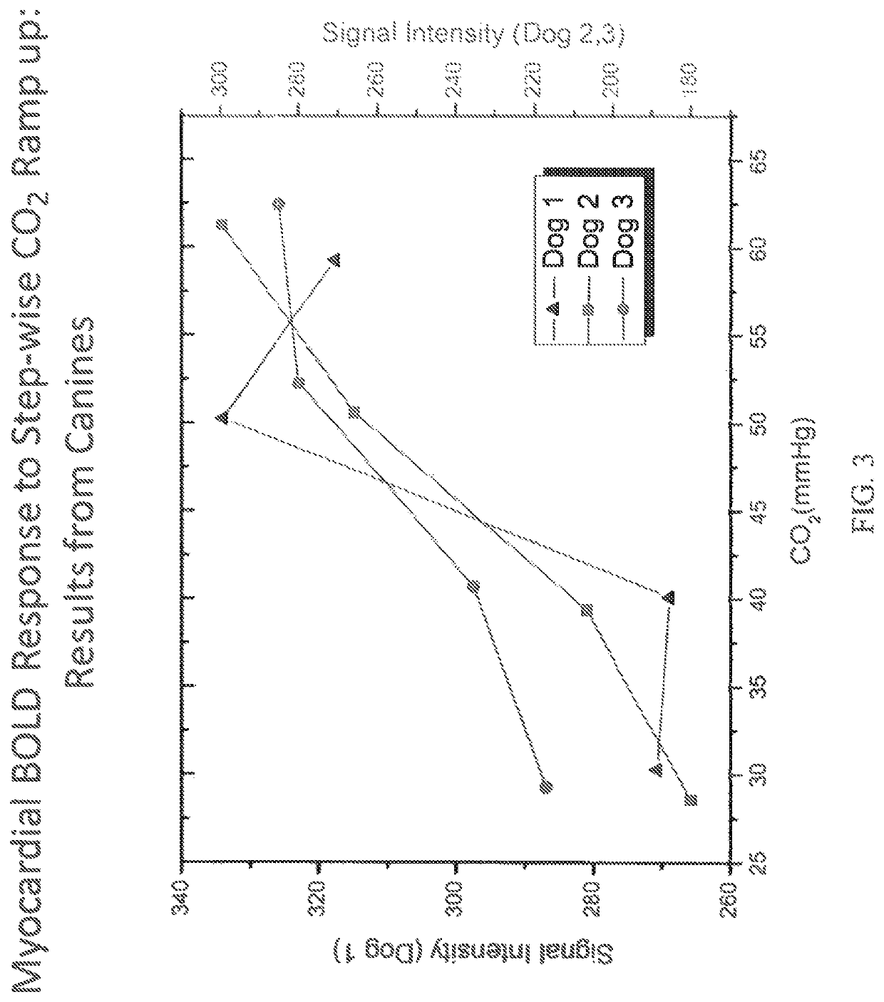 Assessment of coronary heart disease with carbon dioxide