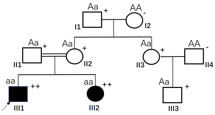 MSH6 gene with mutation at 12759<th> site and application thereof