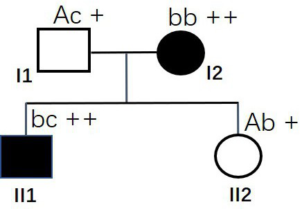 MSH6 gene with mutation at 12759<th> site and application thereof