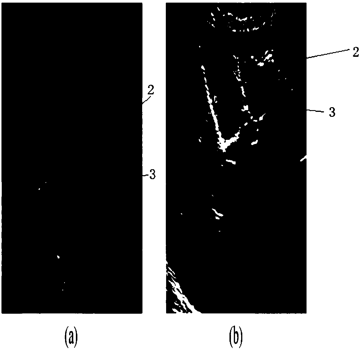 An MSPCNN-based gallstone ultrasonic image full-automatic segmentation method