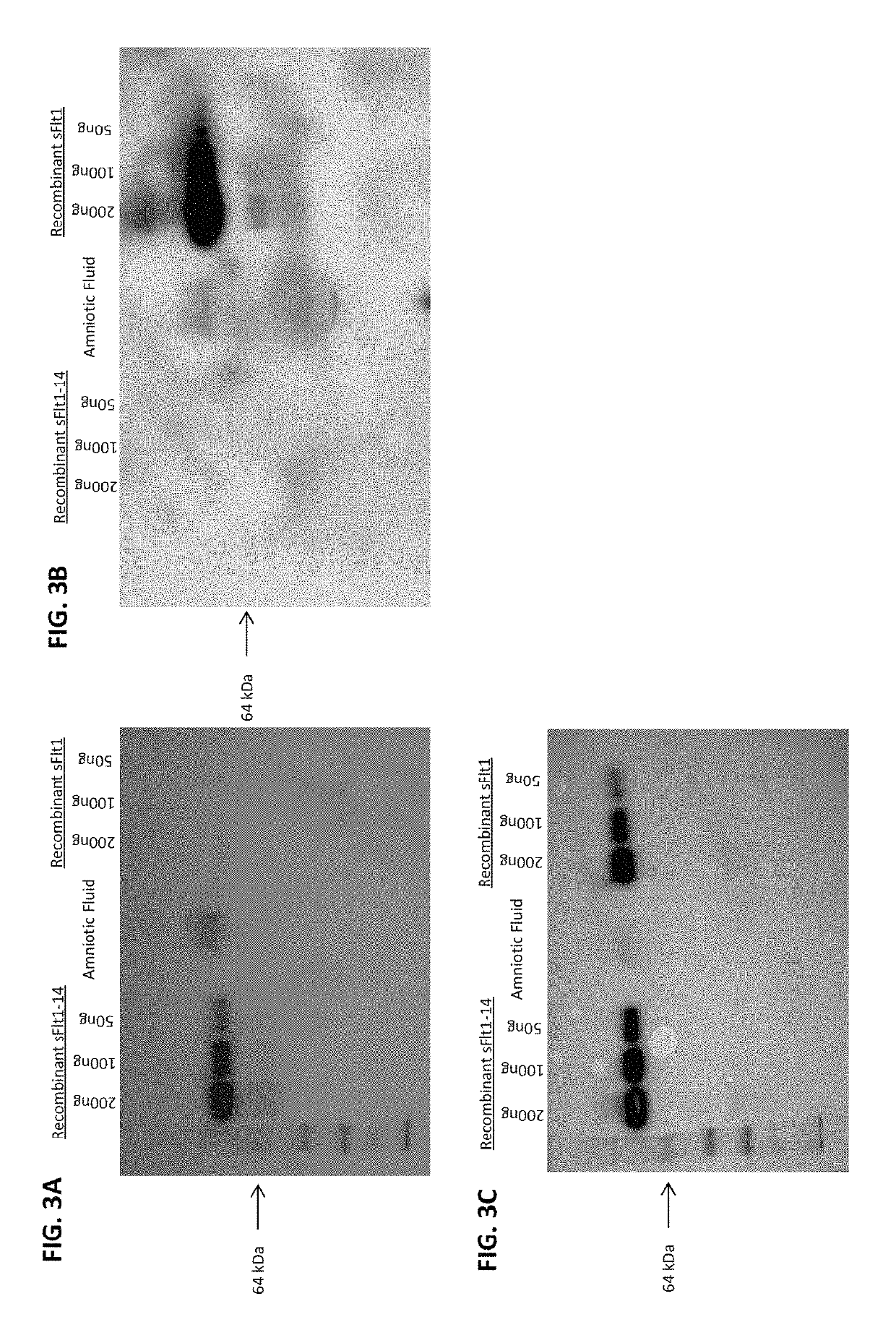 Isoform specific soluble FMS-like tyrosine kinase (sFlt) binding agents and uses thereof