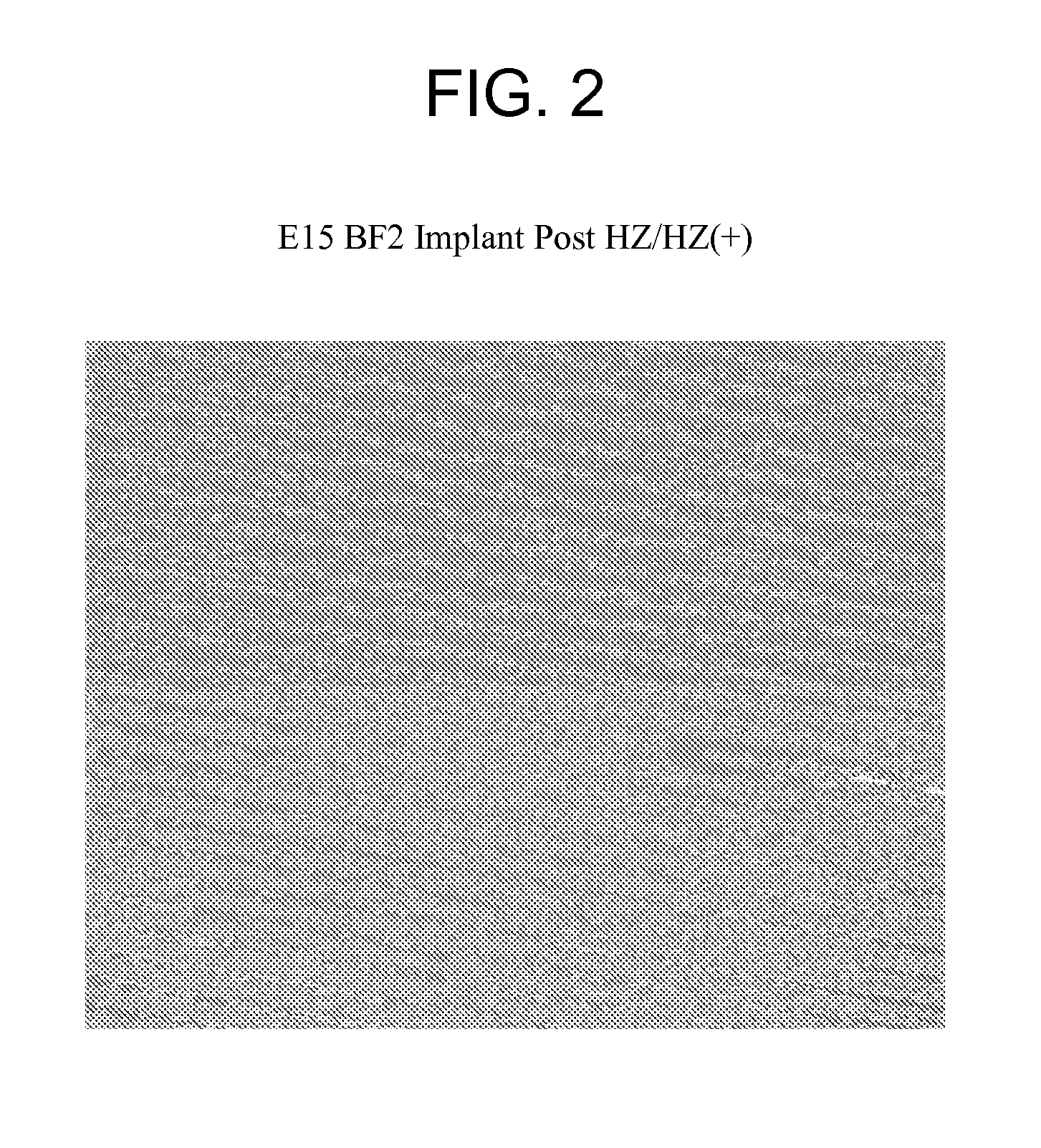 Methods for removing photoresist