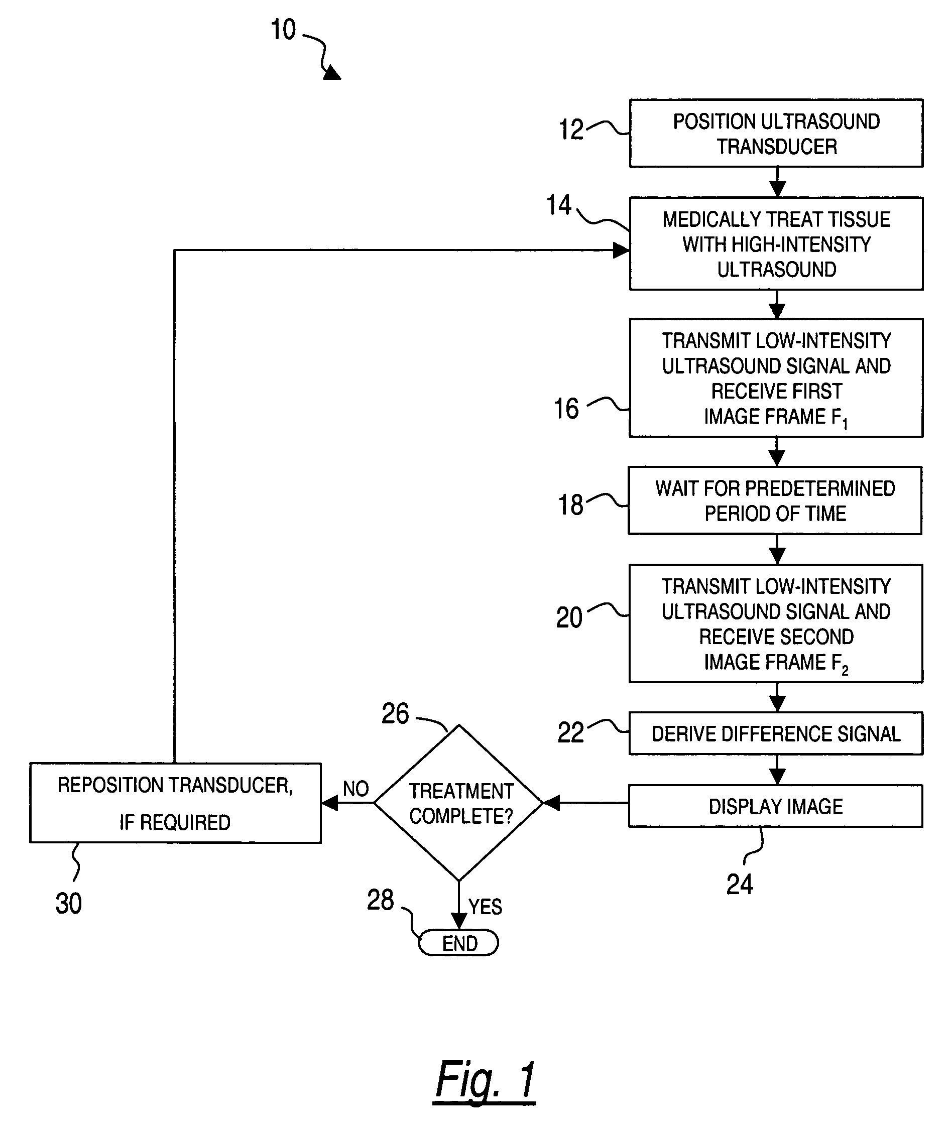 Method for monitoring of medical treatment using pulse-echo ultrasound