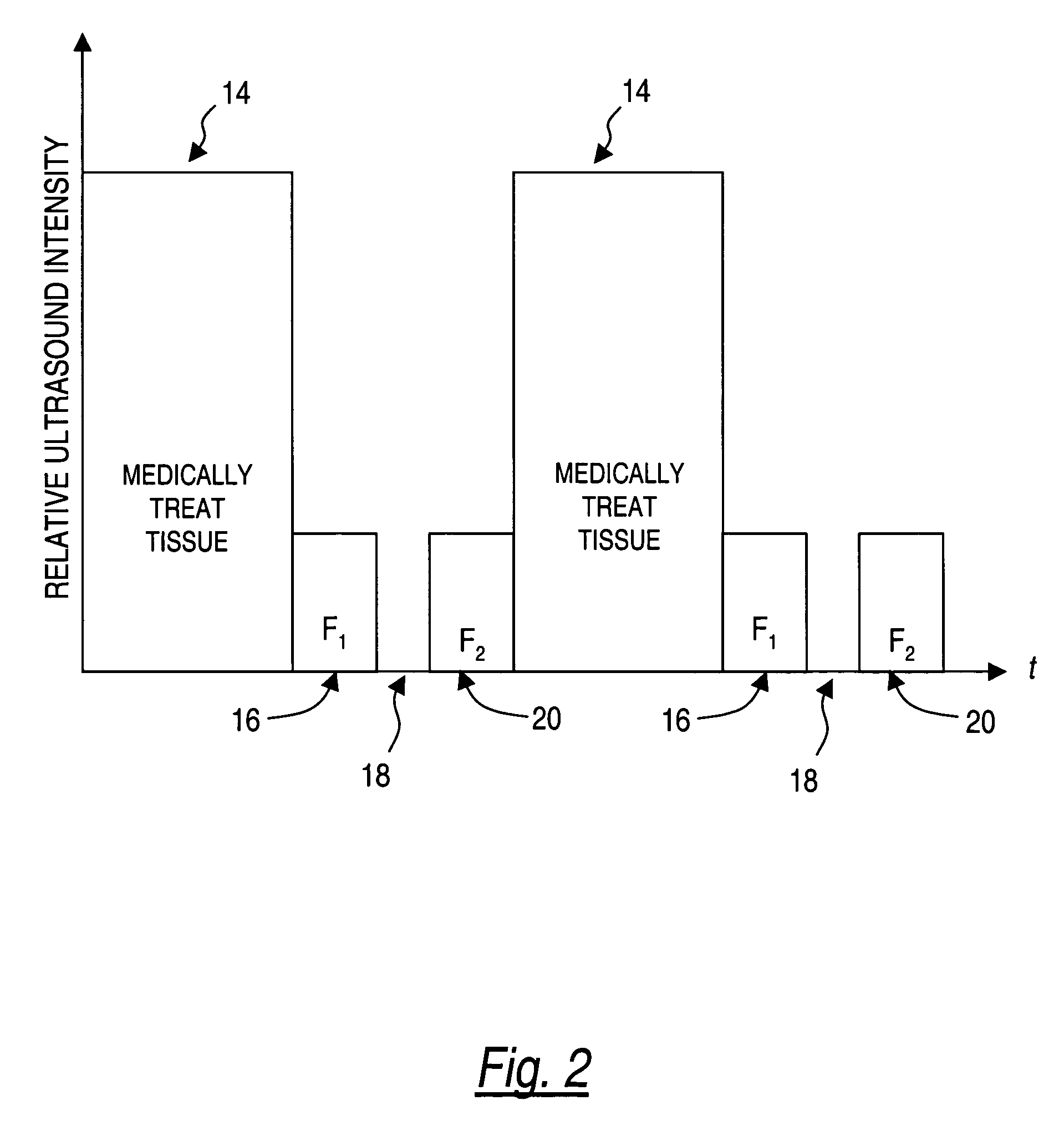 Method for monitoring of medical treatment using pulse-echo ultrasound