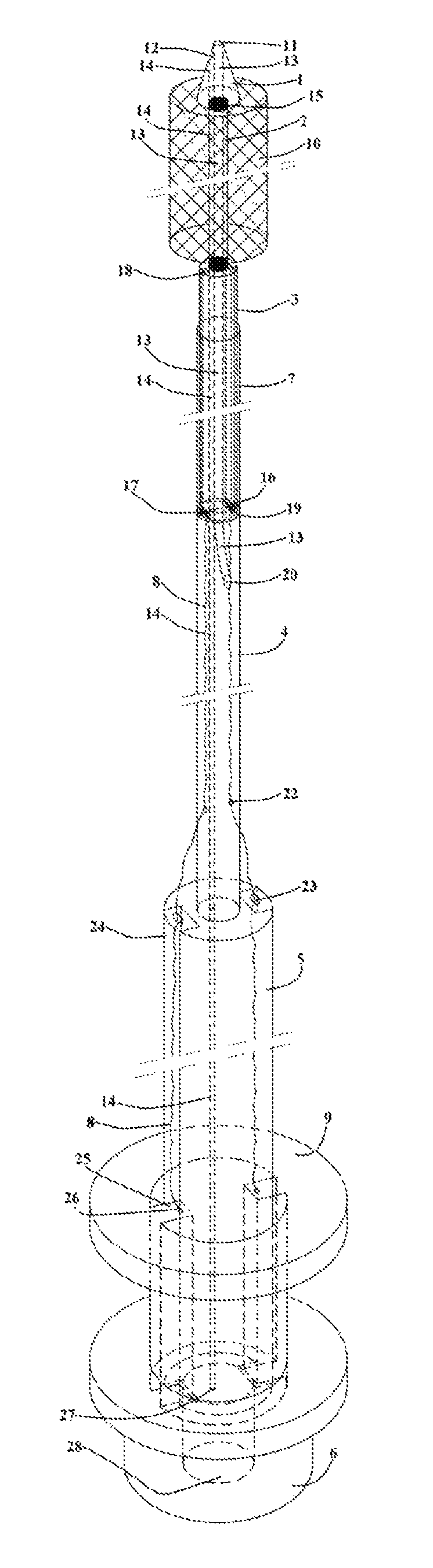 Short sheath delivery system for biliary metal stent via endoscope