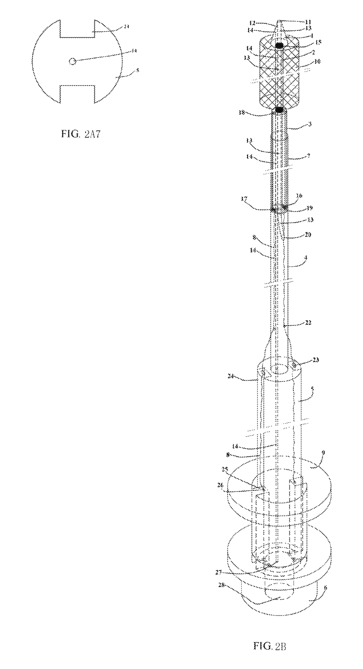 Short sheath delivery system for biliary metal stent via endoscope