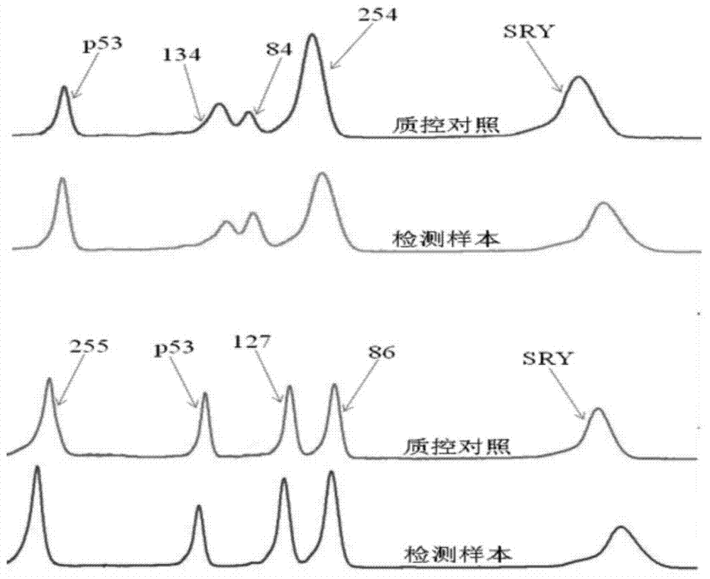 Primer and kit for detecting microdeletion of chromosome Y and use method of primer