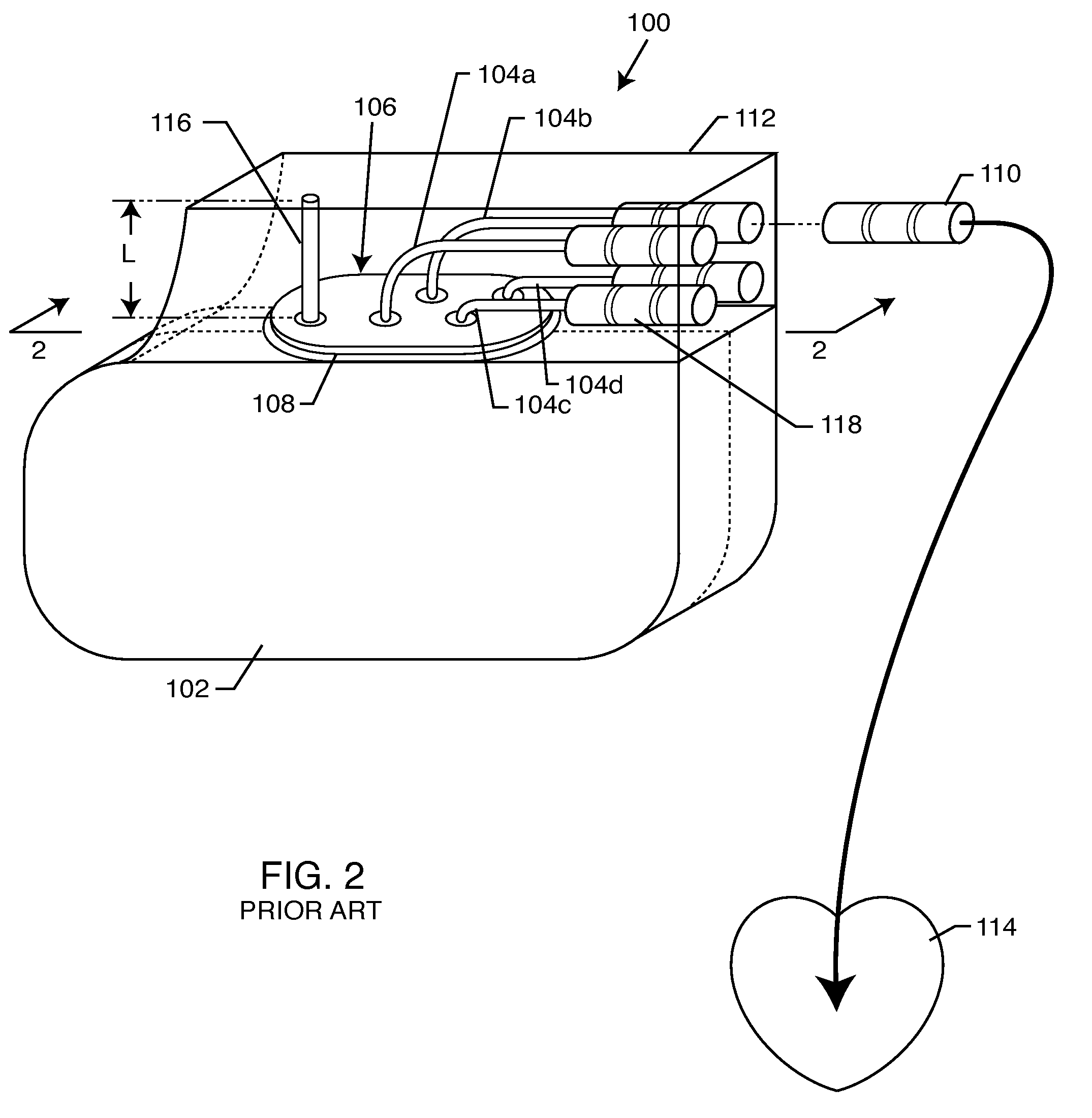 Switch for turning off therapy delivery of an active implantable medical device during MRI scans