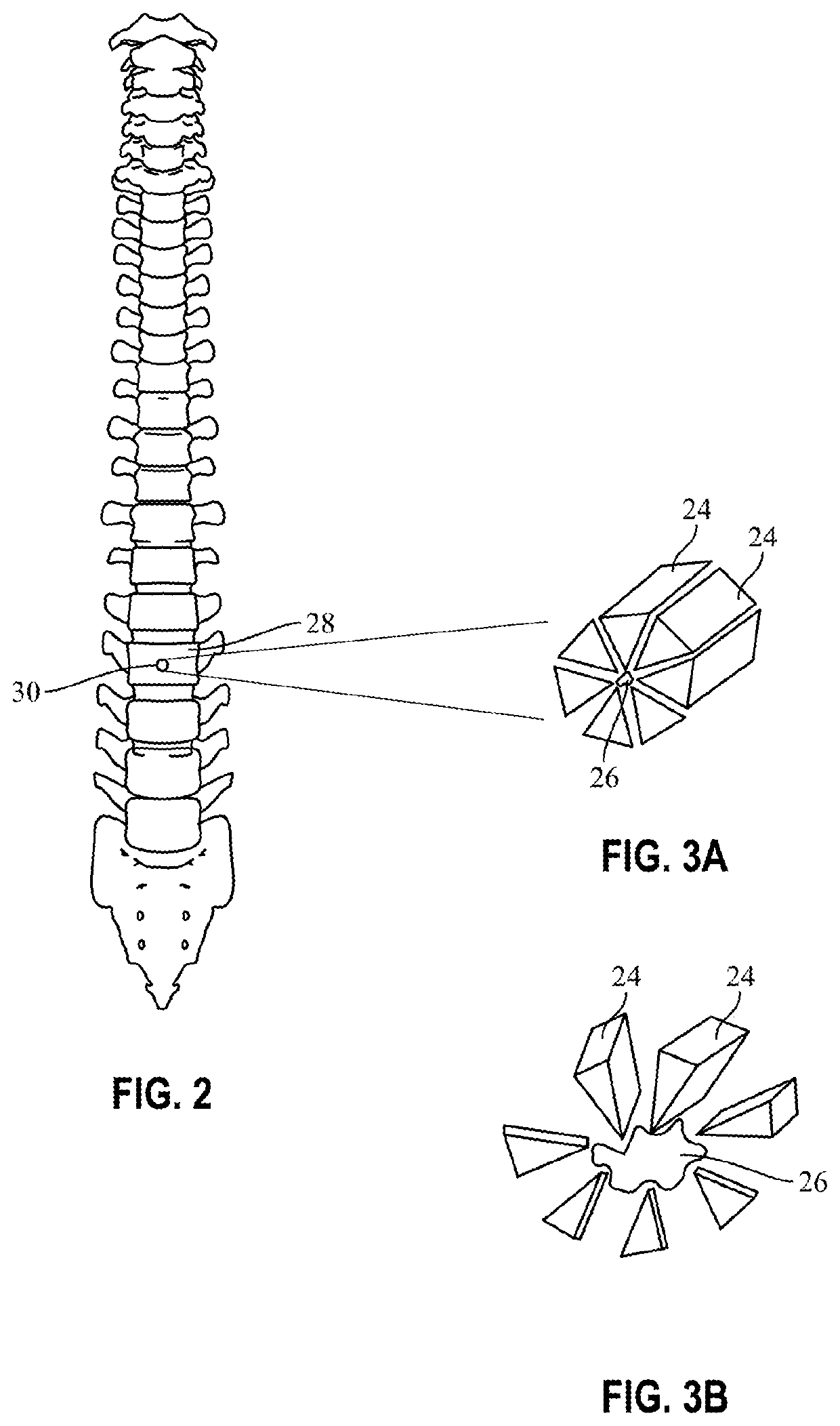 Fluidized brachytherapy system and method