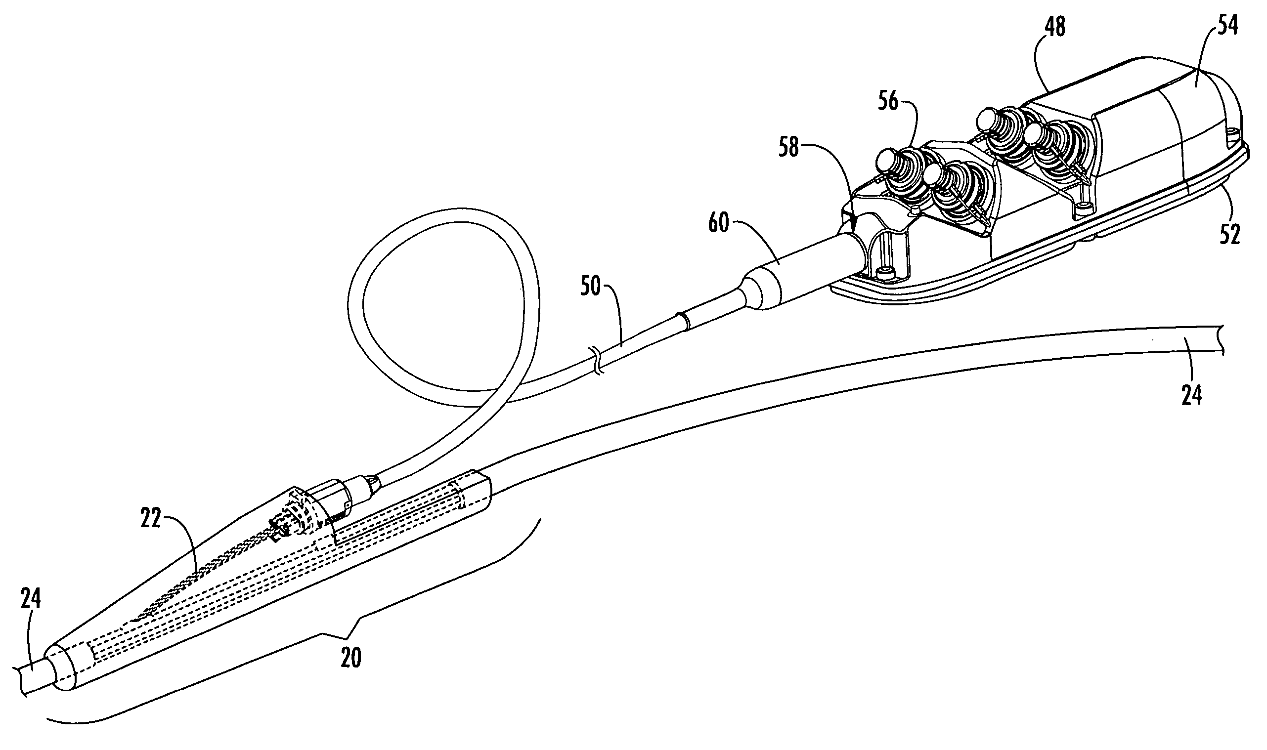 Pre-connectorized fiber optic distribution cable having overmolded access location