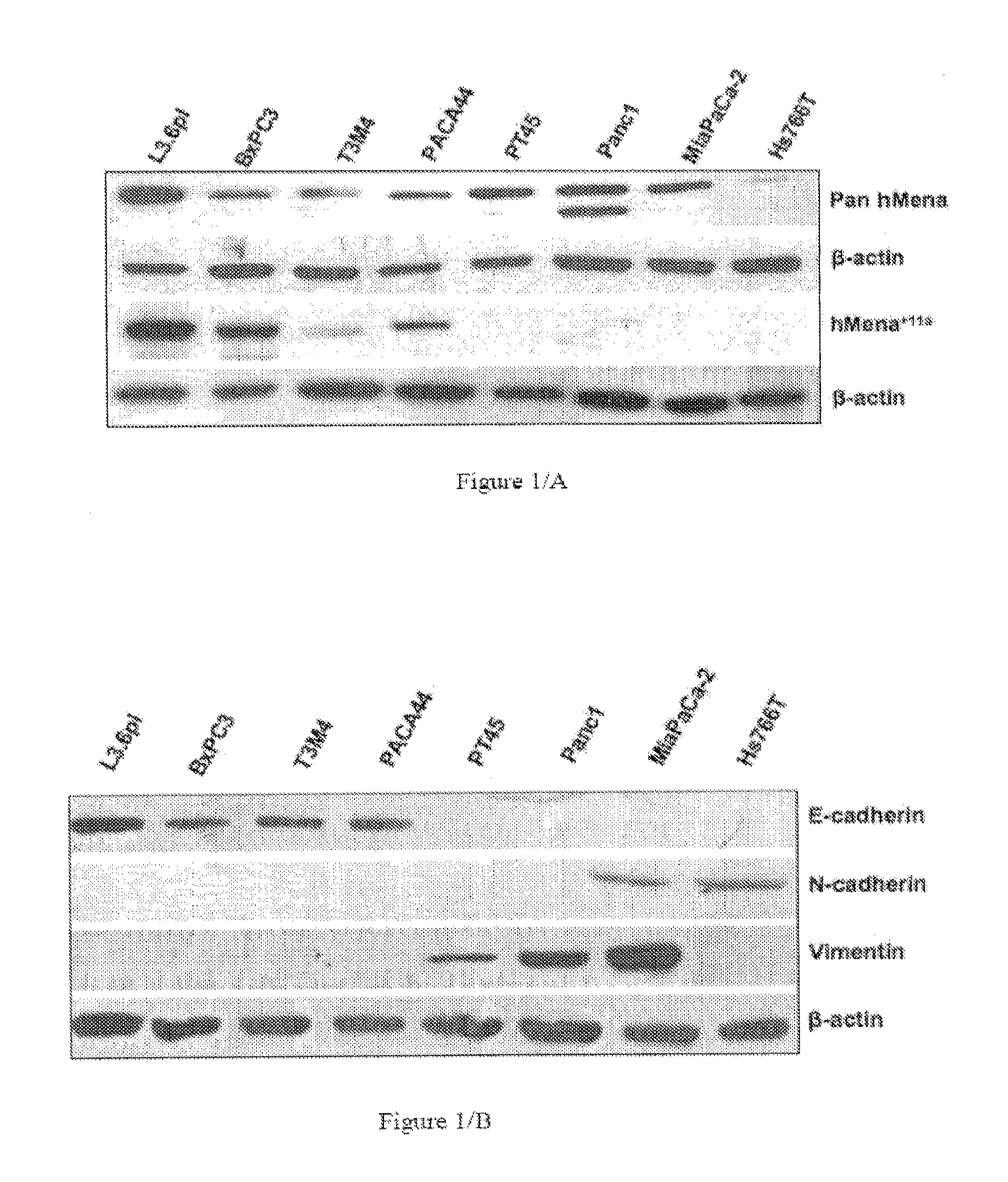 Human mena isoforms serve as markers of epithelial to mesenchymal transition and sensitivity to EGFR inhibition in human cancer cells