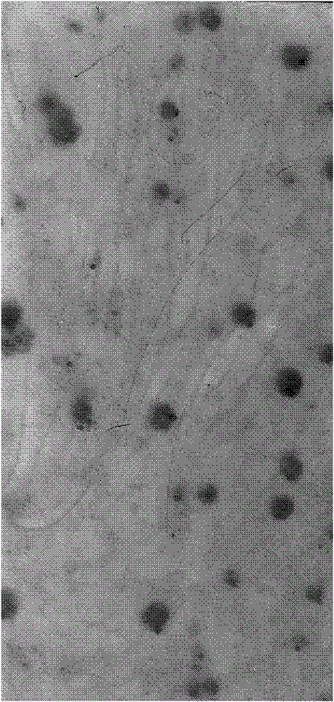 Folate-receptor-mediated pH-sensitive Decoy-ODN (Decoy-oligodeoxynucleotide) nanoparticle preparation and preparation method thereof