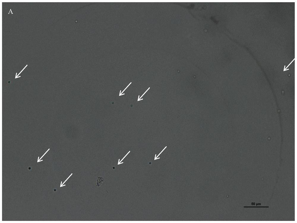 Stable and efficient single spore isolation method for plasmodiophora brassicae woronin serving as protist with strong parasitism