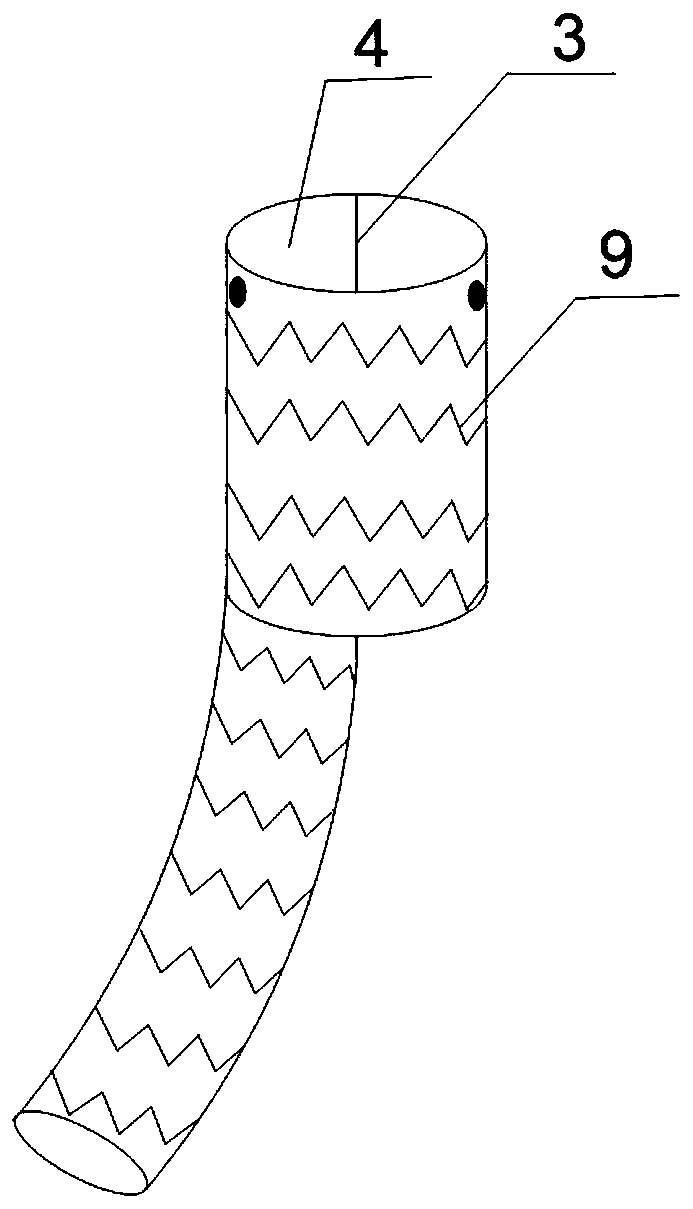 Abdominal aortic aneurysm covered stent