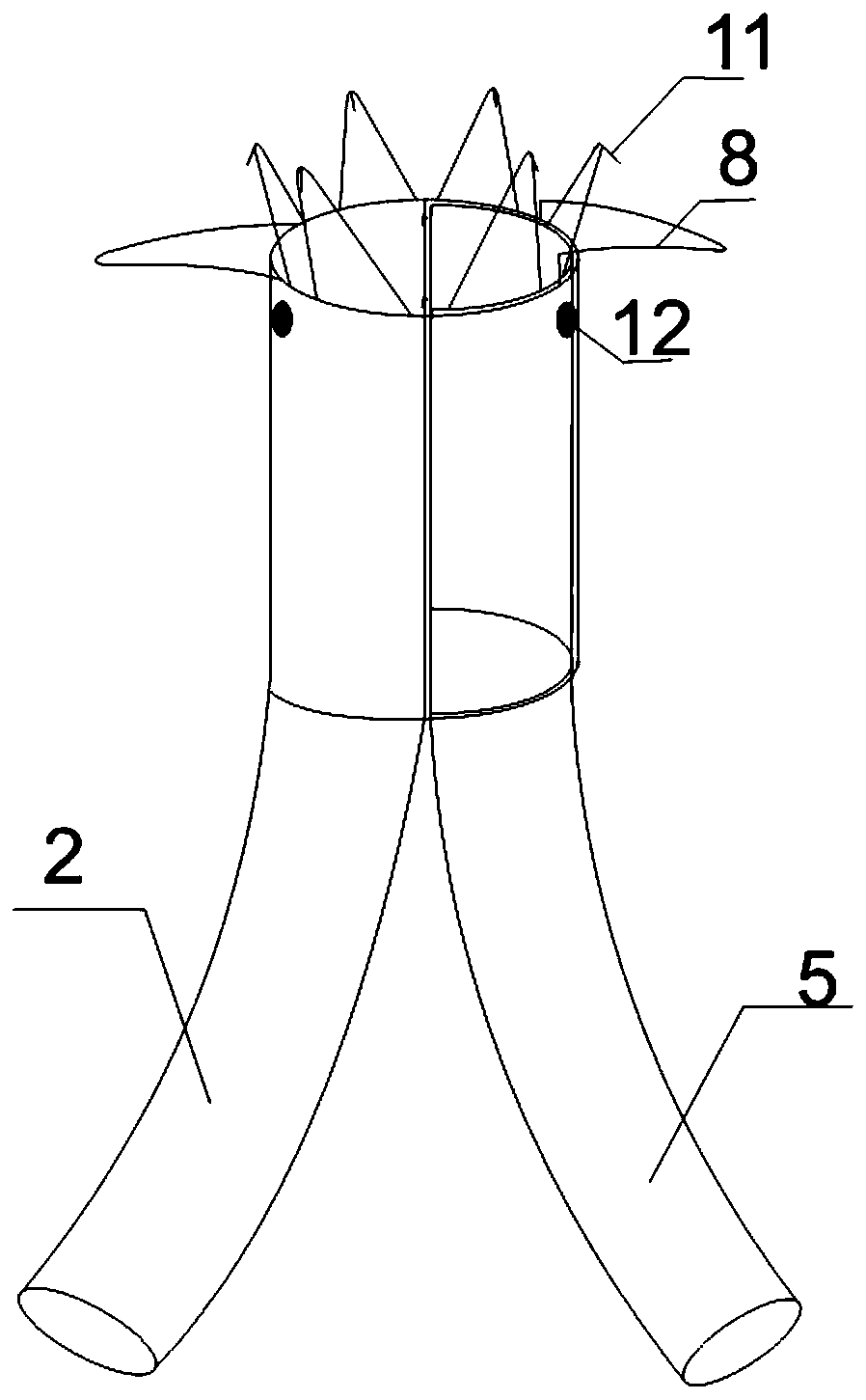 Abdominal aortic aneurysm covered stent