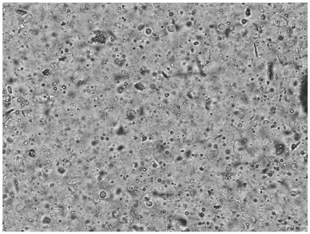 Preparation method and application of blastocystis hominis stained specimen